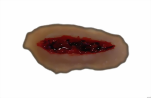 Platzwunde 2 Platzwunde 2