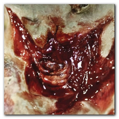 Zombie Torn Throat 3D FX Transfers Zombie Torn Throat 3D FX Transfers