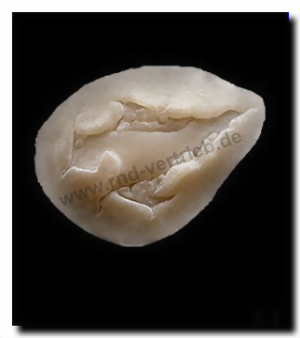 Exposed Bone Exposed Bone