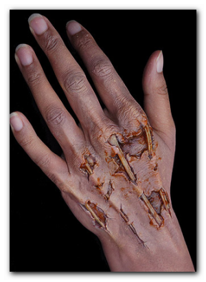 Zombie Hand Prosthetics Zombie Hand Prosthetics